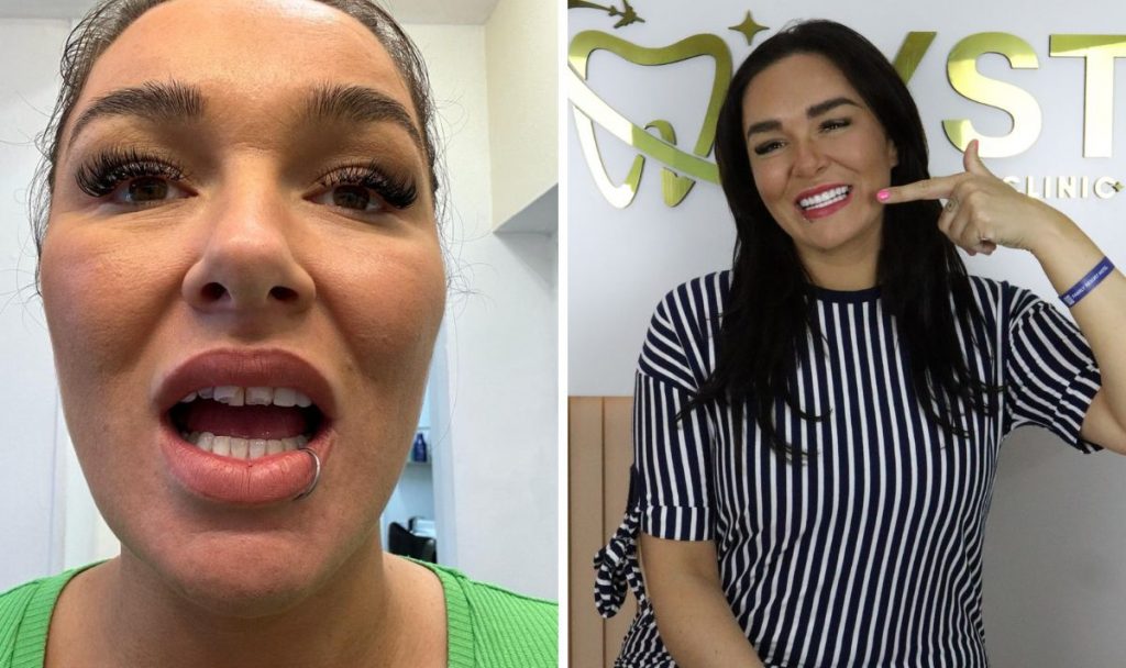 'My teeth were ruined on Harley Street – so I got the damage fixed in Turkey' Turkey Teeth